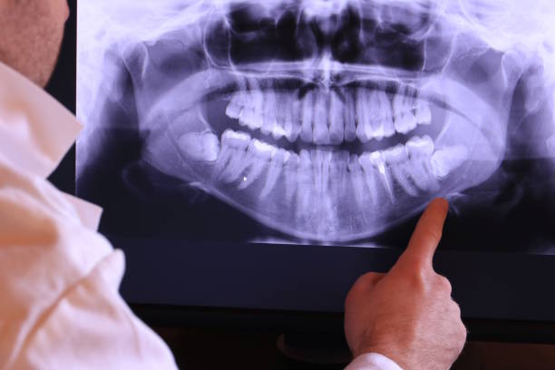 Best Emergency TMJ Treatment in King Of Prussia, PA