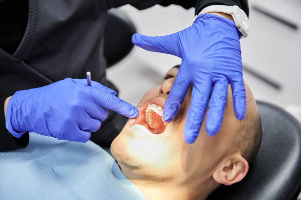 Best Emergency Tooth Extraction in King Of Prussia, PA